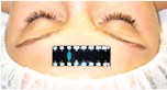 ACCUTHERM liquid crystal forehead temperature indicators