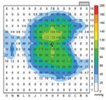 Gel pad illustration of non uniform warming